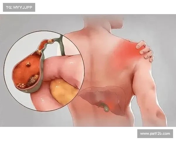 胆结石辐射疼痛的治疗方法 胆结石辐射疼痛的治疗方法